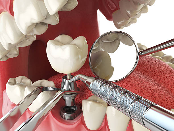 Best Tooth Infection Emergency Dentist  in Mammoth Lakes, CA